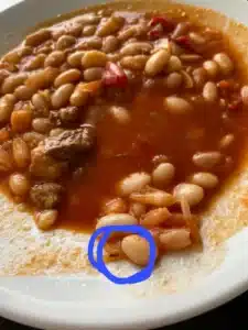 aydin-adu-hastanesinde-yemek-krizi-buyuyor-3
