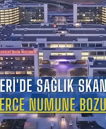kayseride-saglik-skandali-binlerce-numune-bozuldu