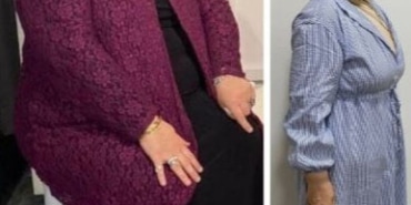 54 yaşındaki Hatice Yıldırım, 1 yılda 35 kilo verdi