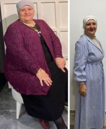 54 yaşındaki Hatice Yıldırım, 1 yılda 35 kilo verdi