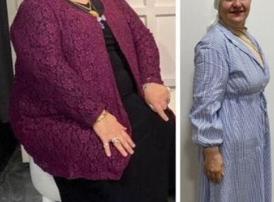 54 yaşındaki Hatice Yıldırım, 1 yılda 35 kilo verdi