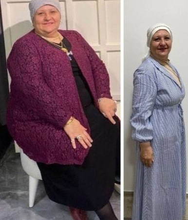 54 yaşındaki Hatice Yıldırım, 1 yılda 35 kilo verdi