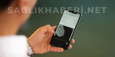 Yapay Zekâ ile Kanserde Erken Teşhis MAMOSİS