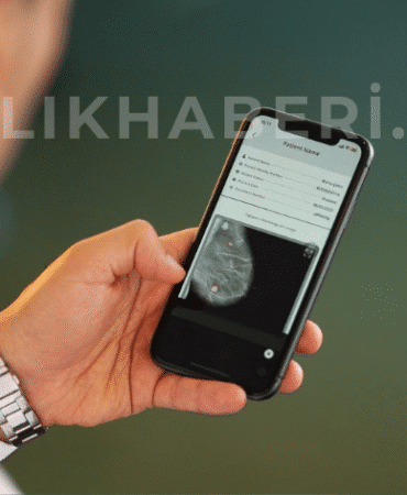 Yapay Zekâ ile Kanserde Erken Teşhis MAMOSİS