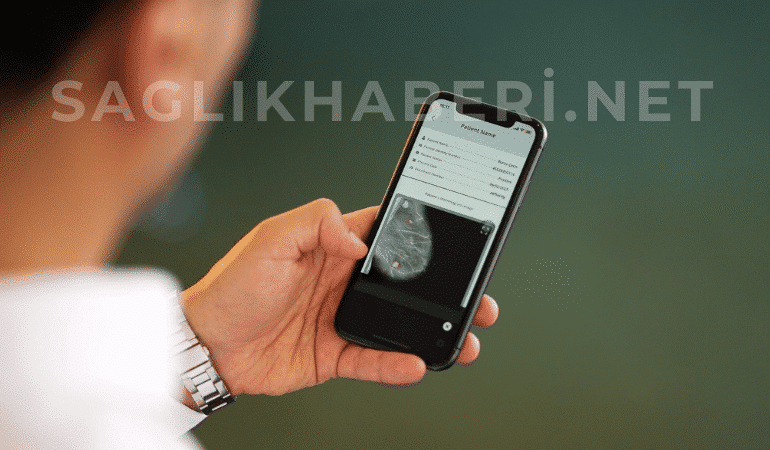 Yapay Zekâ ile Kanserde Erken Teşhis MAMOSİS