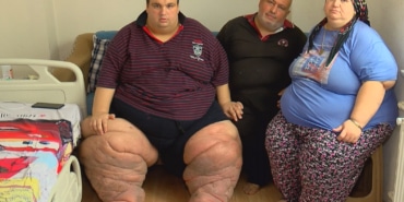İstanbul - 270 kilo Mehmet: 15 aydır evden çıkamıyorum, yardım edin