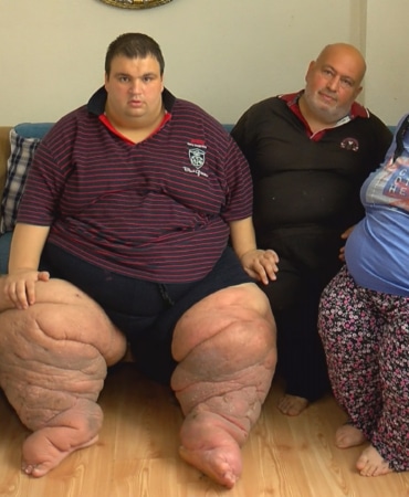 İstanbul - 270 kilo Mehmet: 15 aydır evden çıkamıyorum, yardım edin