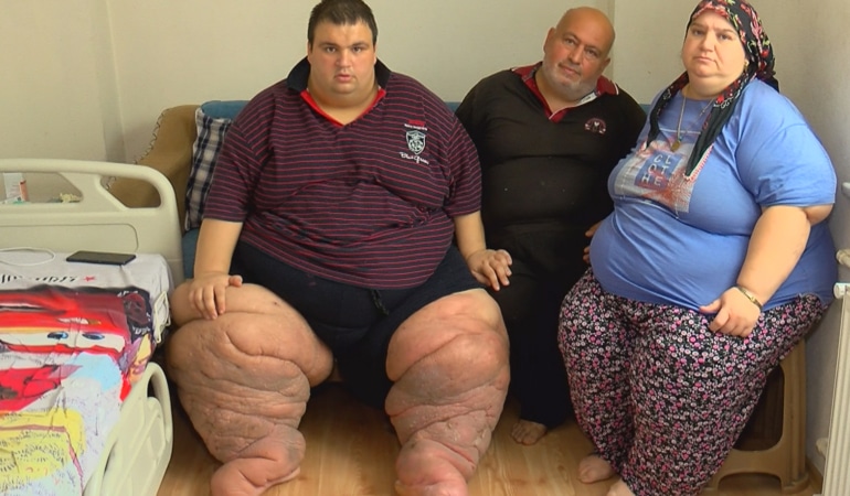 İstanbul - 270 kilo Mehmet: 15 aydır evden çıkamıyorum, yardım edin