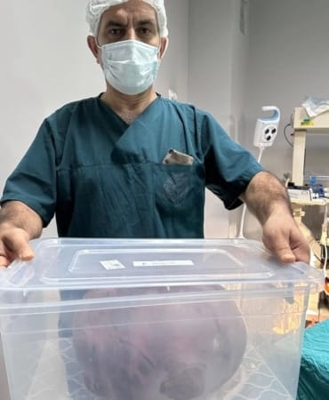 Yumurtalıklarındaki 9 kiloluk kitle operasyonla çıkarıldı