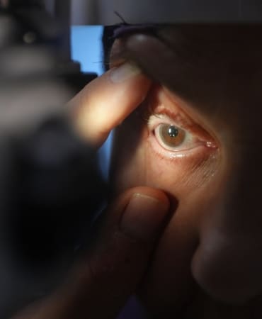 Görme kaybı yaşayan hasta, tedaviyle sağlığına kavuştu