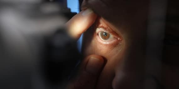 Görme kaybı yaşayan hasta, tedaviyle sağlığına kavuştu