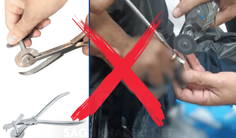 Batman Eğitim Araştırma Hastanesi’nde Malzeme Krizi Yüzük Kesme Pensi Bulunamadı