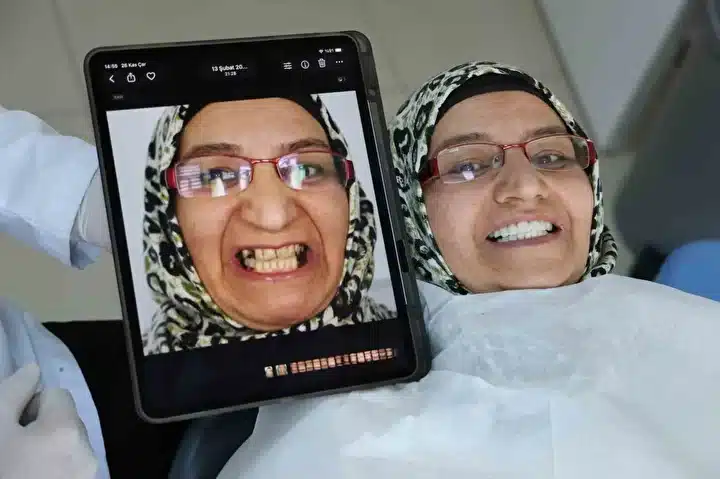 Sivaslı Akademisyenden Diş Tedavisinde Devrim: İmplant Yerine 4 Seansta Doğal Dişe Dönüş (resim 2) – saglikhaberi.net Sivaslı Akademisyenden Diş Tedavisinde Devrim: İmplant Yerine 4 Seansta Doğal Dişe Dönüş (resim 1) – saglikhaberi.net