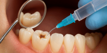 diş çürüklerini onaran jel 2