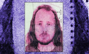 saç ektirip dişlerini yaptıran ingiliz öldü