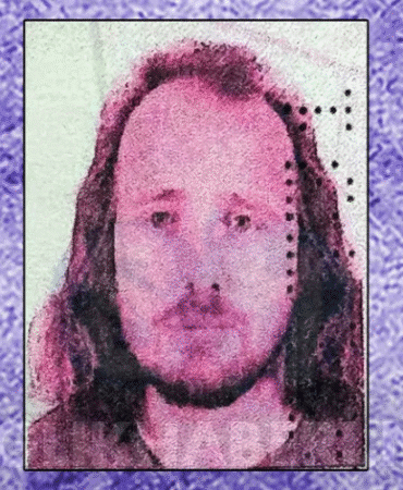 saç ektirip dişlerini yaptıran ingiliz öldü