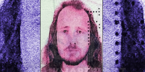 İstanbul’da Saç Ekimi ve Diş Tedavisi İçin Gelen İngiliz Vatandaşının Ölümü Üzerine Soruşturma Başlatıldı