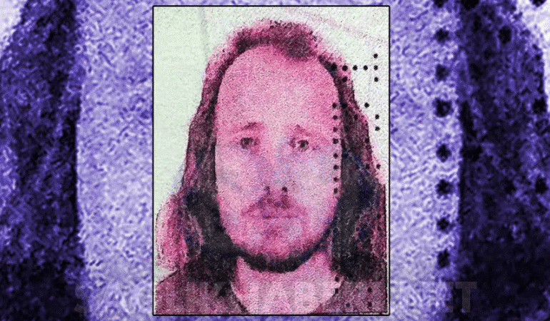 saç ektirip dişlerini yaptıran ingiliz öldü