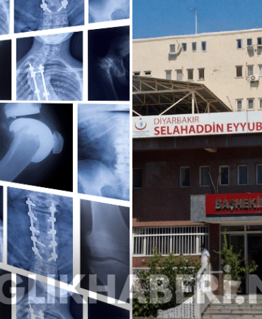 Diyarbakır’da Sağlık Skandalı 75 Hastanın Sağlam Kemiğine Para İçin Platin Takıldı