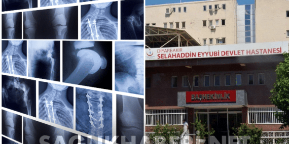Diyarbakır’da Sağlık Skandalı: 75 Hastanın Sağlam Kemiğine “Para İçin” Platin Takıldı