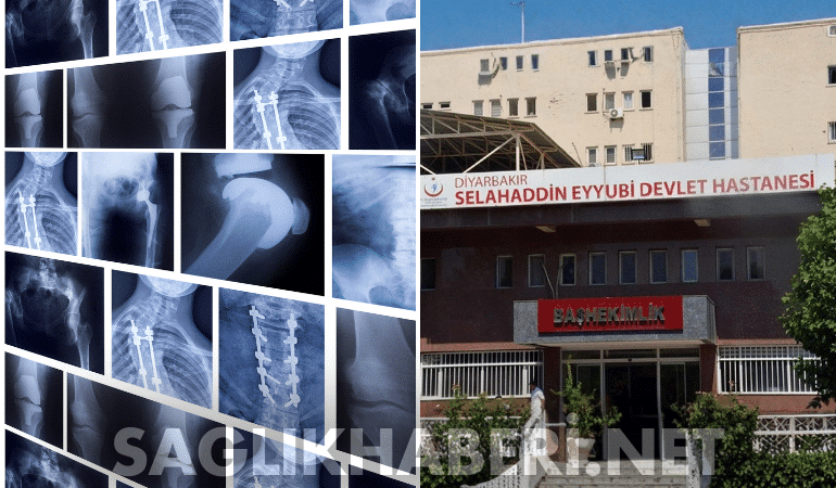 Diyarbakır’da Sağlık Skandalı: 75 Hastanın Sağlam Kemiğine “Para İçin” Platin Takıldı