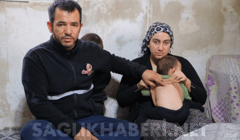 Kahramanmaraş’ta Akılalmaz Sağlık Skandalı: 1 Yaşındaki Bebeğin Belinden Zımba Teli Çıktı