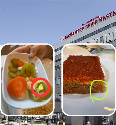 Gaziantep Şehir Hastanesinde Yemek Skandalı: Turşudan Çiğnenmiş Sakız Çıktı! (resim 3) – saglikhaberi.net gaziantep şehir hastanesi yemek skandalı