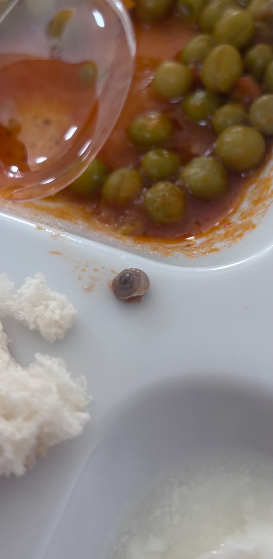 Hatay İskenderun Devlet Hastanesi’nde Yemek Skandalı: Hastalara Dağıtılan Menüden Salyangoz Çıktı! (resim 1) – saglikhaberi.net