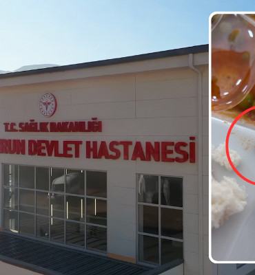 Hatay İskenderun Devlet Hastanesi’nde Yemek Skandalı: Hastalara Dağıtılan Menüden Salyangoz Çıktı! (resim 8) – saglikhaberi.net Hatay İskenderun Devlet Hastanesi yemek skandalı manşet