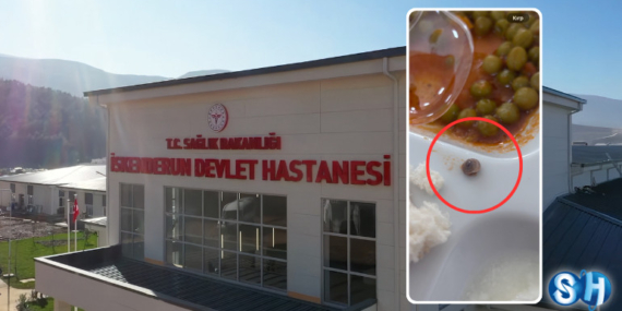 Hatay İskenderun Devlet Hastanesi’nde Yemek Skandalı: Hastalara Dağıtılan Menüden Salyangoz Çıktı!