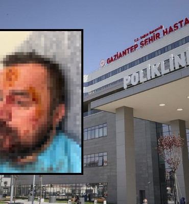 Gaziantep Şehir Hastanesi acil tıp asistanı Dr. Ferhat Arslan yaralı