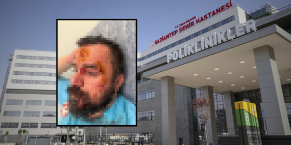 Gaziantep Şehir Hastanesi Acil Servisinde Doktor Kavgası: Sıcak Su ve Kupa ile Saldırı İddiası!